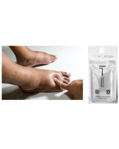 PROMOZIONE FANGO ANTIEDEMA